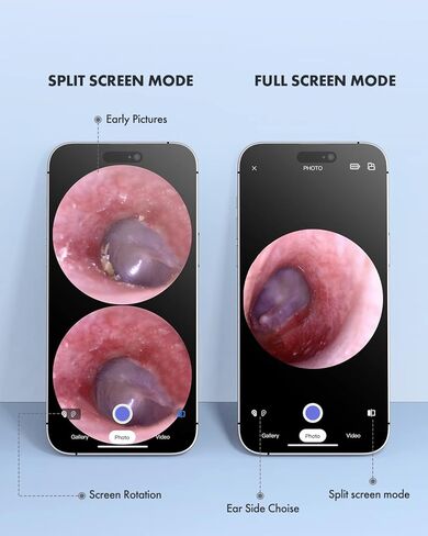 كاميرا أذن Anykit اللاسلكية مع رؤية مزدوجة، نطاق أذن WiFi 3.9 مم 720PHD مع أداة إزالة شمع الأذن للأطفال والكبار والحيوانات الأليفة، متوافقة مع Android وiPhone in Kuwait