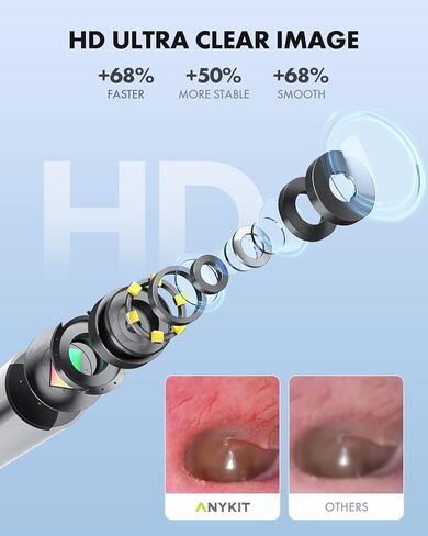 كاميرا أذن Anykit اللاسلكية مع رؤية مزدوجة، نطاق أذن WiFi 3.9 مم 720PHD مع أداة إزالة شمع الأذن للأطفال والكبار والحيوانات الأليفة، متوافقة مع Android وiPhone in Kuwait