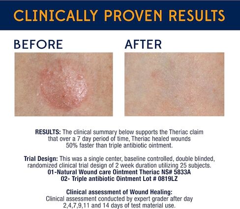 Theriac Advanced Manuka Honey Healing Ointment – Naturally Heals 50% Faster Than Triple Antibiotic/Ideal for Minor Cuts, Scrapes, and Burns / (0.5 Oz) in Saudi Arabia
