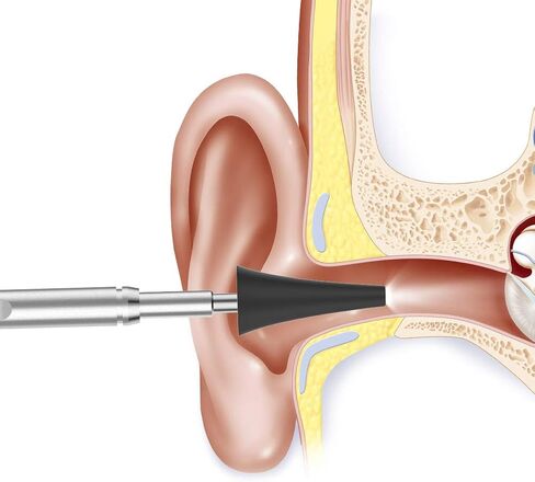 أغطية كاميرا الأذن من Teslong للاستعمال مرة واحدة، 9 منظار، 4 قطع للأذن، 1 حزمة من أغطية الأذن، ملحقات فقط لنطاق الأذن NTE100i، قطر 0.16 بوصة أو 4.3 مم. in Kuwait