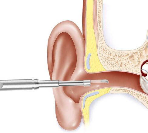أغطية كاميرا الأذن من Teslong للاستعمال مرة واحدة، 9 منظار، 4 قطع للأذن، 1 حزمة من أغطية الأذن، ملحقات فقط لنطاق الأذن NTE100i، قطر 0.16 بوصة أو 4.3 مم. in Kuwait