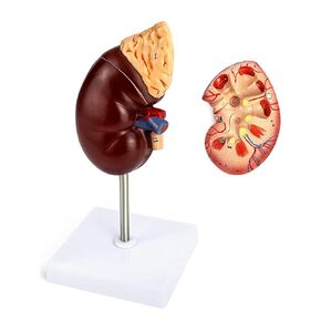 QWORK Life-Size Kidney Model, Divided into 2 Parts Showing Internal Structure A Normal Kidney Human Anatomy Replica for Doctors Office Educational Tool in Kuwait