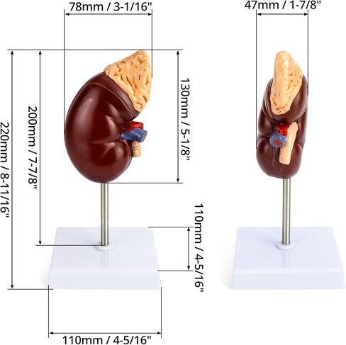 QWORK Life-Size Kidney Model, Divided into 2 Parts Showing Internal Structure A Normal Kidney Human Anatomy Replica for Doctors Office Educational Tool in Kuwait
