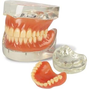نموذج عرض الأسنان القياسي للبالغين مع أسنان قابلة للإزالة للتدريس والعرض النظيف والتعليم ونموذج الأسنان القياسي in Kuwait