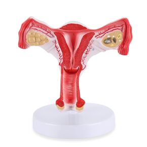 RONTEN 1:1 نموذج مبيض الرحم الأنثوي البشري، نموذج تشريحي للرحم المبيض الثنائي، أداة دراسة القسم التشريحي للتدريس والتعلم والعرض in Kuwait