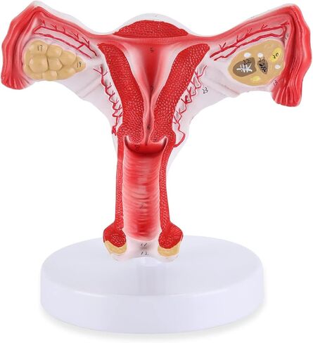 RONTEN 1:1 Human Female Uterus Ovary Model, Anatomical Cross Section Bilateral Ovarian Uterus Model, Anatomical Section Study Tool for Teaching, Learning, Display in Kuwait