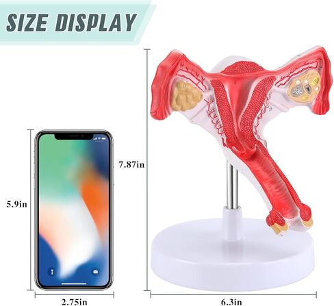RONTEN 1:1 Human Female Uterus Ovary Model, Anatomical Cross Section Bilateral Ovarian Uterus Model, Anatomical Section Study Tool for Teaching, Learning, Display in Kuwait