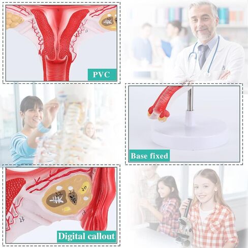 RONTEN 1:1 Human Female Uterus Ovary Model, Anatomical Cross Section Bilateral Ovarian Uterus Model, Anatomical Section Study Tool for Teaching, Learning, Display in Kuwait