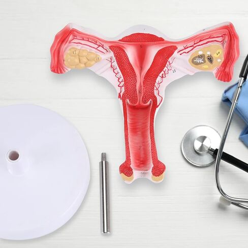 RONTEN 1:1 Human Female Uterus Ovary Model, Anatomical Cross Section Bilateral Ovarian Uterus Model, Anatomical Section Study Tool for Teaching, Learning, Display in Kuwait