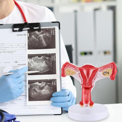RONTEN 1:1 Human Female Uterus Ovary Model, Anatomical Cross Section Bilateral Ovarian Uterus Model, Anatomical Section Study Tool for Teaching, Learning, Display in Kuwait