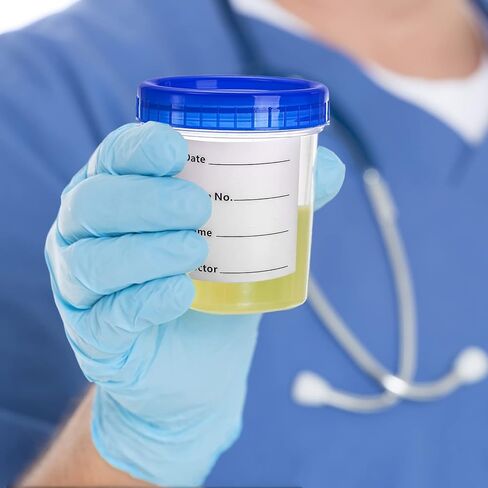 Frcctre 30 Pack 4 Oz Specimen Cups with Leak Proof Screw on Lid, Disposable Non-Sterile Urine Specimen Cups with 40 Pcs Stickers, Specimen Collection Containers Specimen Jar in Saudi Arabia