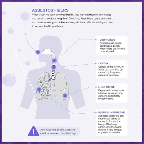 balorp DIY اختبار الأسبستوس 2 PK - يشمل جميع رسوم المختبر - اختبار سقف الفشار، والبلاط، والعزل، واللاصق، والمصطكي، والجدران الجافة وغيرها من المواد للأسبستوس، DIY408 in Kuwait