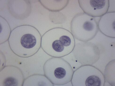 انقسام الإسكاريس والبصل، شريحة مجهرية مُجهزة - 75 × 25 مم - انقسام النبات والحيوان، المجهر التمهيدي - Eisco Labs in Kuwait