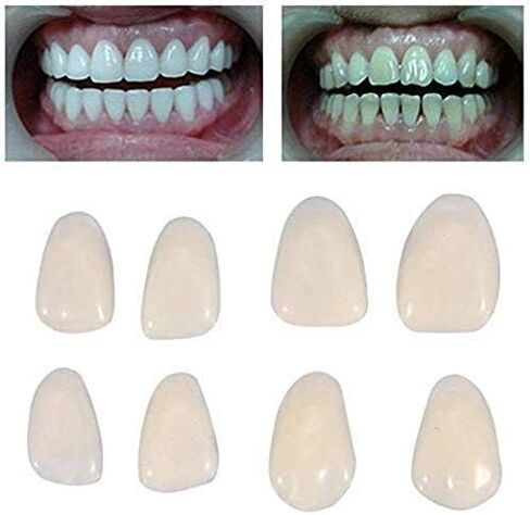 4 علب لأسنان التاج المؤقت للعناية بالأسنان من الصين in Kuwait