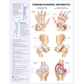 Understanding Arthritis Anatomical Chart in Saudi Arabia
