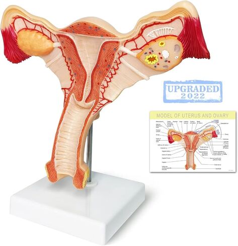 EVOTECH Human Uterus and Ovary Model, 2022 Newest Female Reproductive Organ Model, Female Genital Organ, Shows Uterus, Ovary, Vagina, Uterine Medical Teaching Anatomical Gynecology in Saudi Arabia