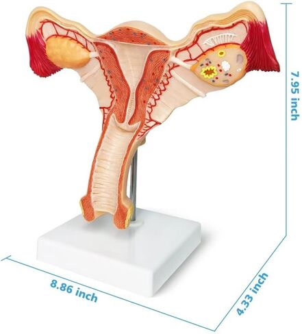 EVOTECH Human Uterus and Ovary Model, 2022 Newest Female Reproductive Organ Model, Female Genital Organ, Shows Uterus, Ovary, Vagina, Uterine Medical Teaching Anatomical Gynecology in Saudi Arabia