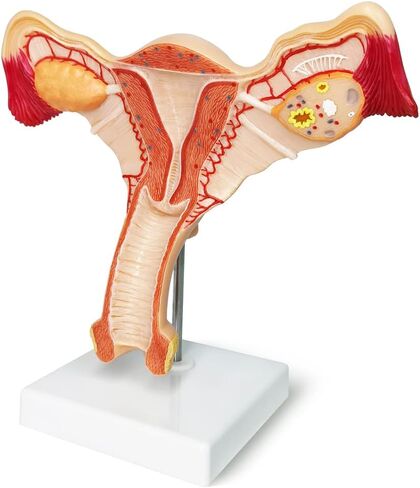 EVOTECH Human Uterus and Ovary Model, 2022 Newest Female Reproductive Organ Model, Female Genital Organ, Shows Uterus, Ovary, Vagina, Uterine Medical Teaching Anatomical Gynecology in Saudi Arabia