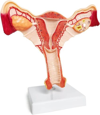 EVOTECH Human Uterus and Ovary Model, 2022 Newest Female Reproductive Organ Model, Female Genital Organ, Shows Uterus, Ovary, Vagina, Uterine Medical Teaching Anatomical Gynecology in Saudi Arabia