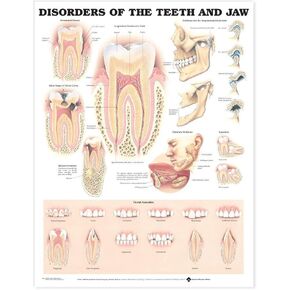 Disorders of the Teeth and Jaw Anatomical Chart in Saudi Arabia