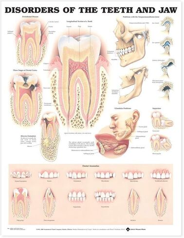 Disorders of the Teeth and Jaw Anatomical Chart in Kuwait