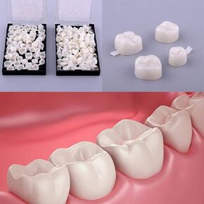 100pcs Temporary Crown Veneers Material Anterior Front Back Molar Teeth by Superdental in Kuwait