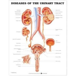 Diseases of the Urinary Tract Anatomical Chart in Kuwait