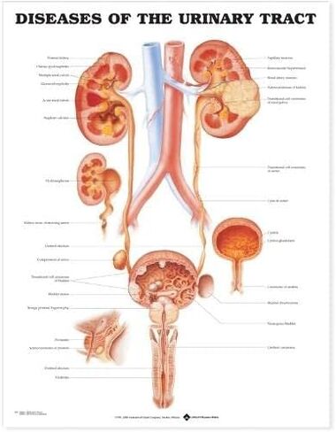 Diseases of the Urinary Tract Anatomical Chart in Kuwait