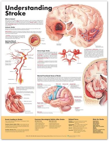 Understanding Stroke Anatomical Chart in Saudi Arabia