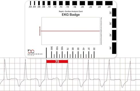 بطاقة شارة EKG PVC - تفسر بدقة شرائط إيقاع ECG/EKG و12 رصاصًا لتخطيط كهربية القلب بدون فرجار EKG - للممرضة التابعة لهيئة الخدمات الصحية الوطنية أو أي شخص في مجال الرعاية الصحية! in Kuwait