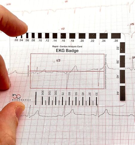 بطاقة شارة EKG PVC - تفسر بدقة شرائط إيقاع ECG/EKG و12 رصاصًا لتخطيط كهربية القلب بدون فرجار EKG - للممرضة التابعة لهيئة الخدمات الصحية الوطنية أو أي شخص في مجال الرعاية الصحية! in Kuwait