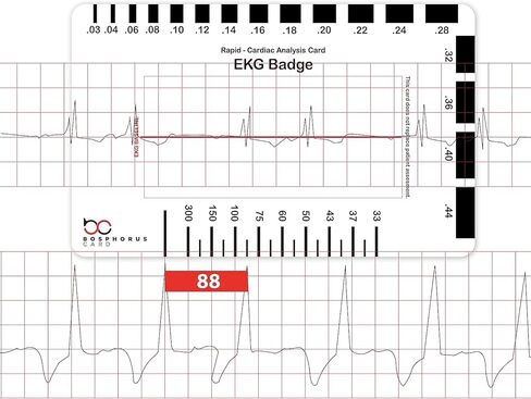 بطاقة شارة EKG PVC - تفسر بدقة شرائط إيقاع ECG/EKG و12 رصاصًا لتخطيط كهربية القلب بدون فرجار EKG - للممرضة التابعة لهيئة الخدمات الصحية الوطنية أو أي شخص في مجال الرعاية الصحية! in Kuwait