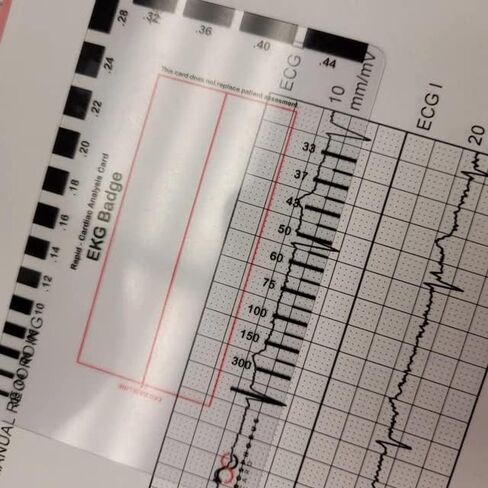 بطاقة شارة EKG PVC - تفسر بدقة شرائط إيقاع ECG/EKG و12 رصاصًا لتخطيط كهربية القلب بدون فرجار EKG - للممرضة التابعة لهيئة الخدمات الصحية الوطنية أو أي شخص في مجال الرعاية الصحية! in Kuwait