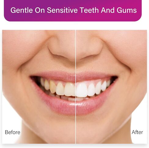 Purple Toothpaste Whitening, Colour Corrector Purple Toothpaste for Teeth Whitening, V34 Color Corrector Serum, Purple Teeth Whitening Toothpaste for Adults, TIK Tok Must Haves 2023. (Violet) in Kuwait