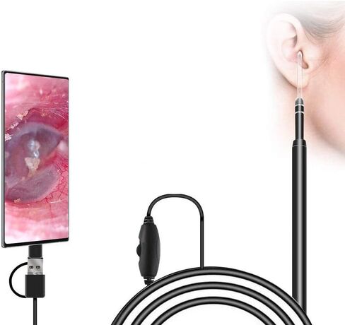 كاميرا منظار الأذن 3 في 1 USB، كاميرا أذن مرئية صغيرة جديدة مطورة بقطر 5.5 مم، منظار أذن عالي الدقة مع أداة تنظيف شمع الأذن و6 مصابيح LED قابلة للتعديل لأجهزة OTG Android وWindows وMac. in Kuwait