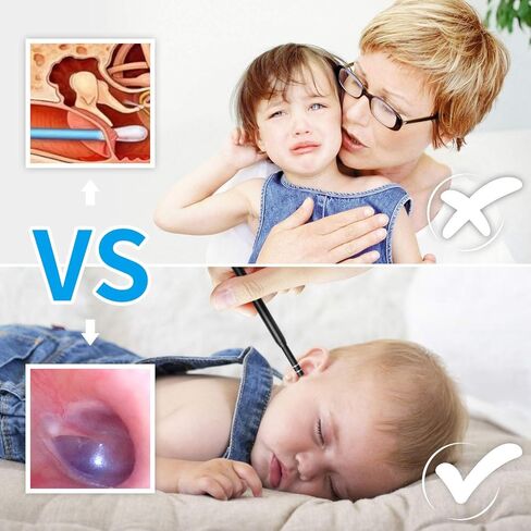 كاميرا منظار الأذن 3 في 1 USB، كاميرا أذن مرئية صغيرة جديدة مطورة بقطر 5.5 مم، منظار أذن عالي الدقة مع أداة تنظيف شمع الأذن و6 مصابيح LED قابلة للتعديل لأجهزة OTG Android وWindows وMac. in Kuwait