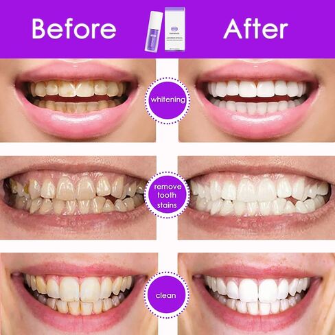 معجون أسنان أرجواني لتبييض الأسنان، جل معجون تبييض الأسنان الأرجواني للأسنان الحساسة، معجون أسنان لتنظيف الأسنان للأسنان الصفراء، مجموعة تبييض الأسنان الأرجوانية وإزالة البقع in Kuwait