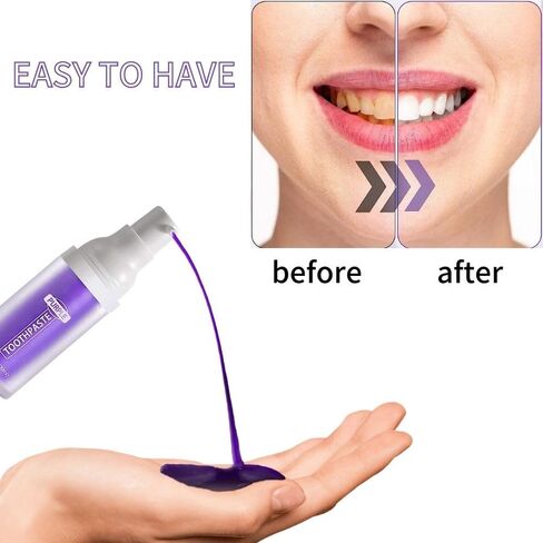 Purple Toothpaste for Teeth Whitening, Purple Toothpaste Whitening, Color Corrector Toothpaste, Purple Teeth Whitening, Teeth Whitening Booster in Kuwait