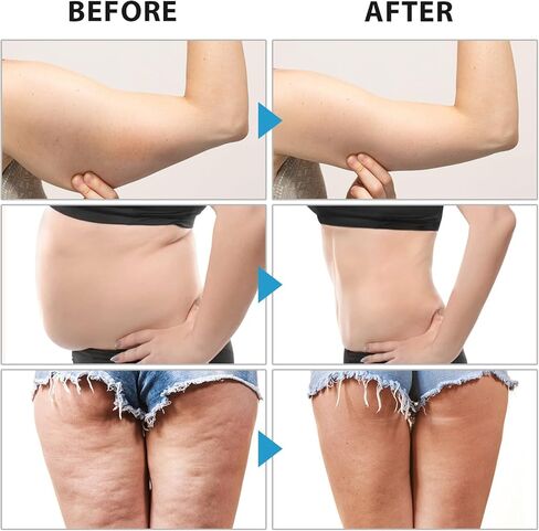 شريط سحري من كاوتيك فون للمعدة (بيج نود / 5 سم × 5 متر) in Kuwait