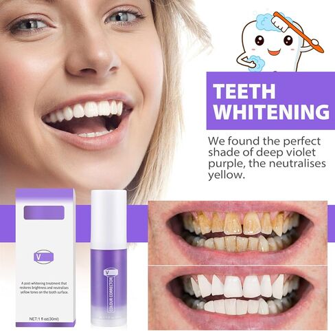 قطعتان من معجون الأسنان الأرجواني لتبييض الأسنان، تبييض معجون الأسنان الأرجواني، معجون أسنان مصحح اللون، إزالة بقع الأسنان، تقليل الاصفرار، مصحح لون الأسنان (30 مل) in Kuwait