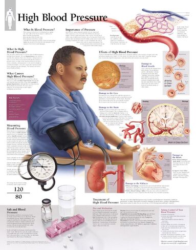 High Blood Pressure chart: Wall Chart in Saudi Arabia