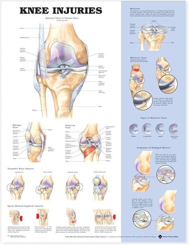 Knee Injuries Anatomical Chart in Saudi Arabia