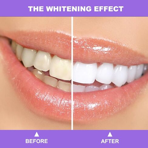 مجموعة تبييض الأسنان، معجون أسنان أرجواني لتبييض الأسنان، إزالة بقع الأسنان، معزز تبييض الأسنان، مصحح لون الأسنان (معجون أسنان أرجواني) in Kuwait