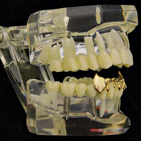 14k Gold Plated Fang Drip Grillz Bottom Teeth Fangs Hip Hop Vampire Dripping Pre-Made Grills in Kuwait