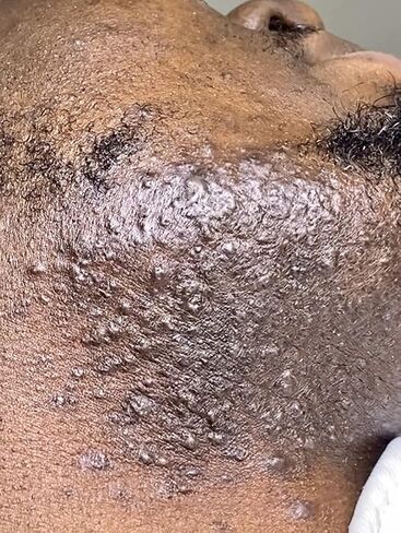 CWHaircare Black Beard beard elixir is an all natural beard growth product that conditions, softens, grows, helps to prevent razor bumps, also adds a beautiful healthy shine and it smells AMAZING!!!  in Saudi Arabia