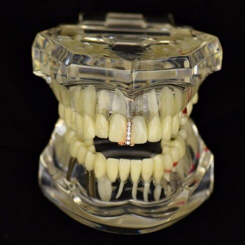 CZ Gap Grillz 14k Rose Gold Plated Cubic Zirconia Bling Tooth Top or Bottom Teeth Single Cap Hip Hop Grills in Saudi Arabia