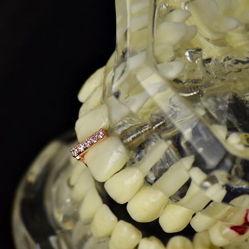 CZ Gap Grillz 14k Rose Gold Plated Cubic Zirconia Bling Tooth Top or Bottom Teeth Single Cap Hip Hop Grills in Saudi Arabia