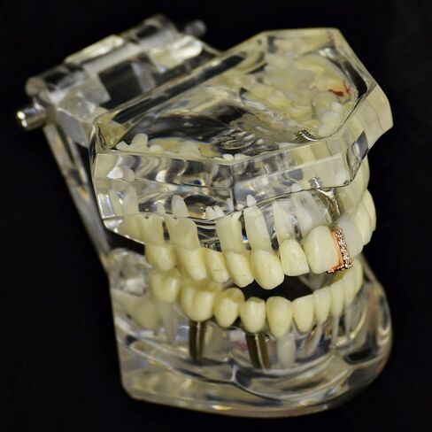CZ Gap Grillz 14k Rose Gold Plated Cubic Zirconia Bling Tooth Top or Bottom Teeth Single Cap Hip Hop Grills in Saudi Arabia