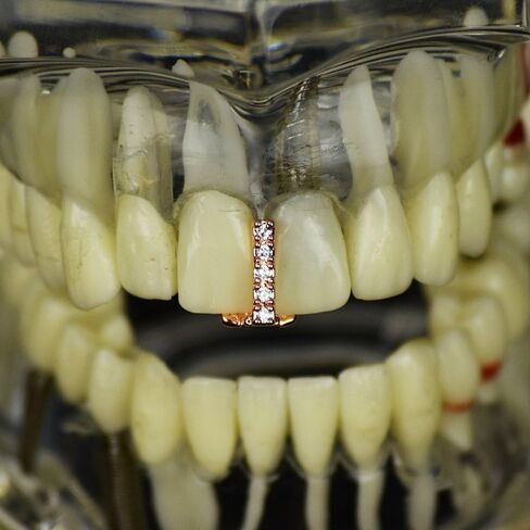 CZ Gap Grillz 14k Rose Gold Plated Cubic Zirconia Bling Tooth Top or Bottom Teeth Single Cap Hip Hop Grills in Saudi Arabia
