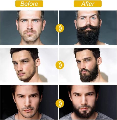 Beard Growth Kit - Beard Kit Gifts Set with 0.25mm Beard Roller, Beard Growth Serum Oil , Beard Balm and Comb, Help Beard and Hair Growth - Gifts for Men Dad Him Boyfriend Husband Brother in Saudi Arabia